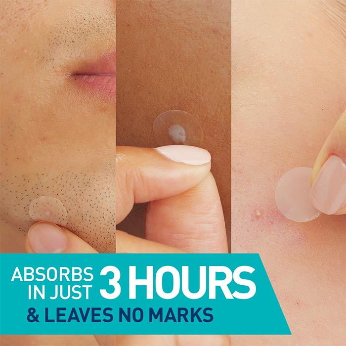 Acne Control Gel