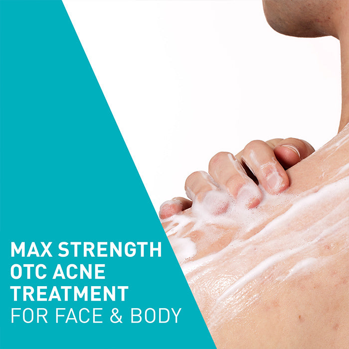 benzoyl-peroxide-face-wash