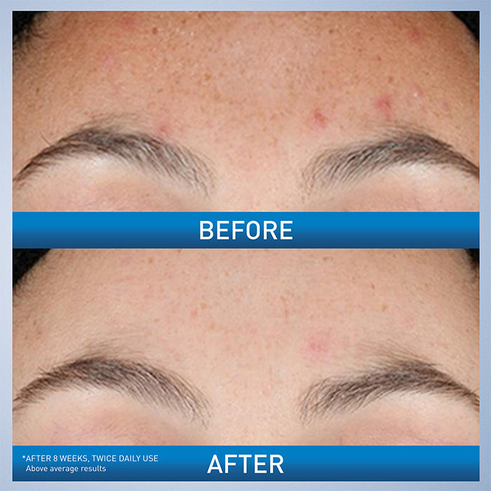 CeraVe Skincare Serums Resurfacing Retinol Serum